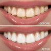 PAP+ Teeth Whitening Strips